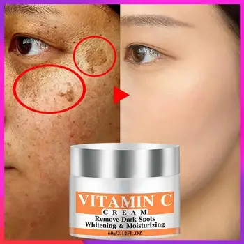 Najnovšie Vitamín C Bielenie Tváre Krém Opravy Fade Pehy Odstrániť Tmavé Škvrny Melanínu Odstraňovač Leštenie Krém Na Tvár