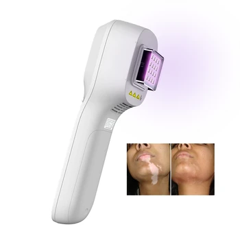Jadro KN-5000H ručné prenosné LED 308nm UVB svetelná terapia stroj pre cielenú liečbu psoriázy vitiligo